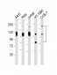 LAMP1 Antibody [Knockout Validated]